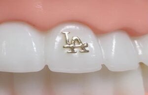 tooth jewels Los Angeles