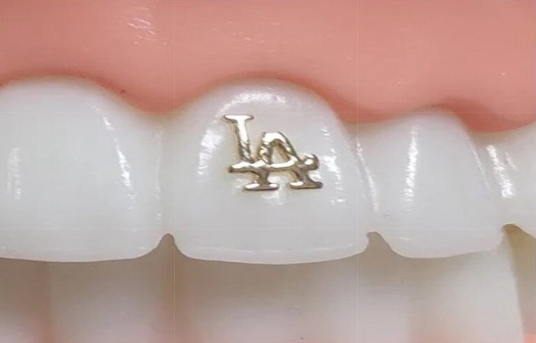 What Dental Bling Says About Style Personalities